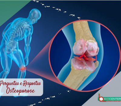 Osteoporose: Perguntas e respostas! (Dicas de Saúde - Laboratório Biocenter)